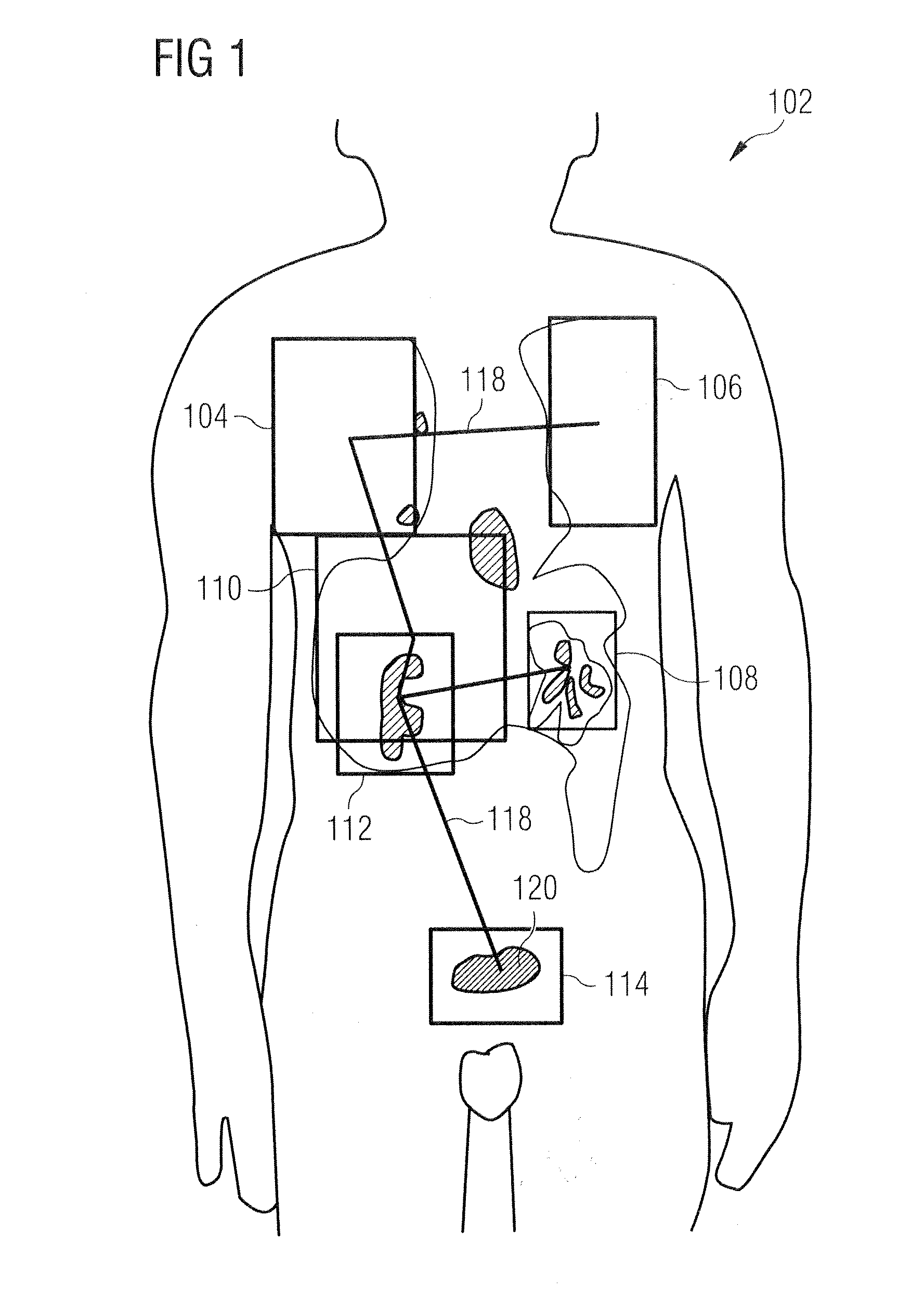 Methods and apparatus for registration of medical images