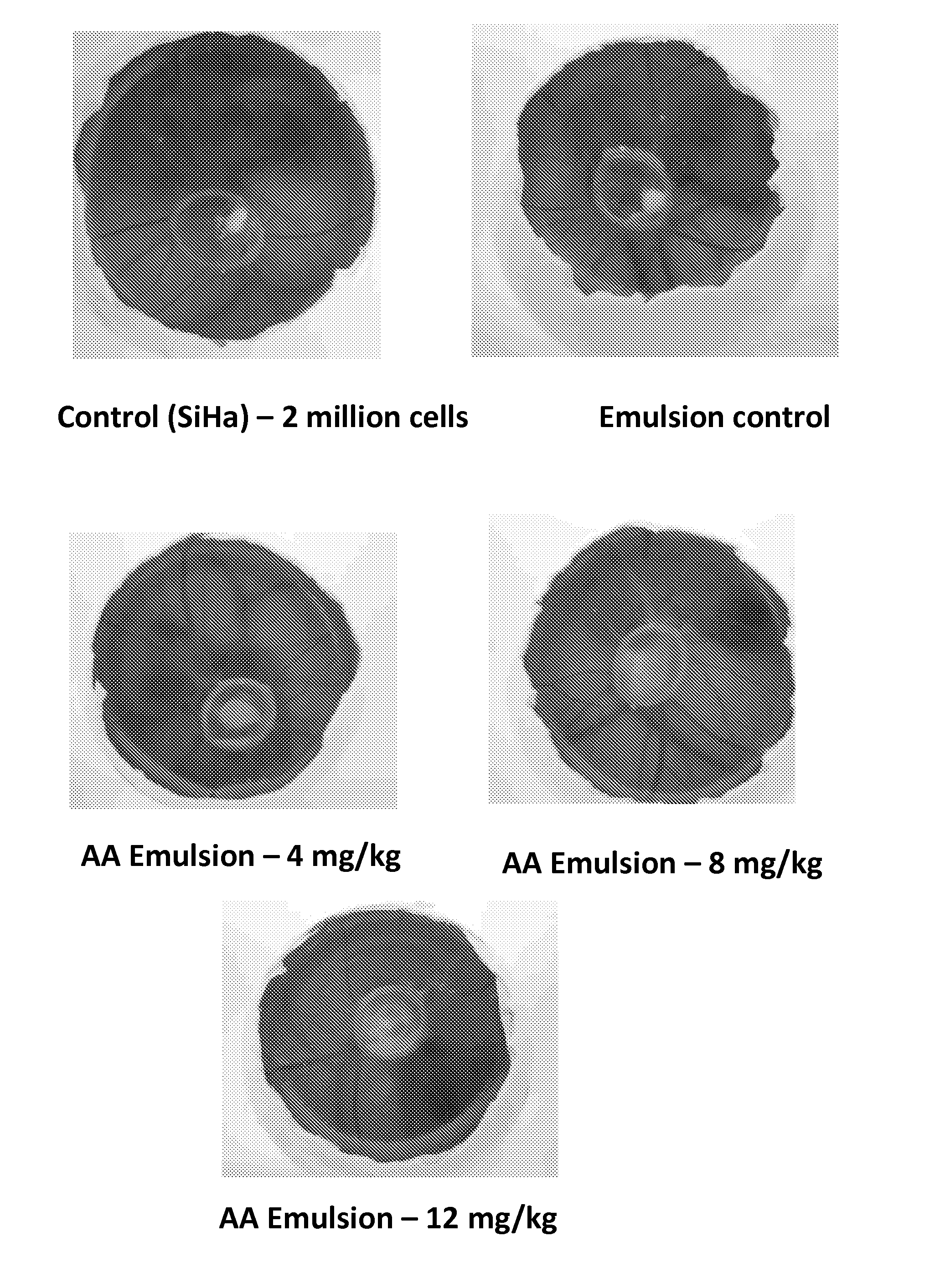 Pharmaceutical compositions of Anisomelic acid and the use thereof