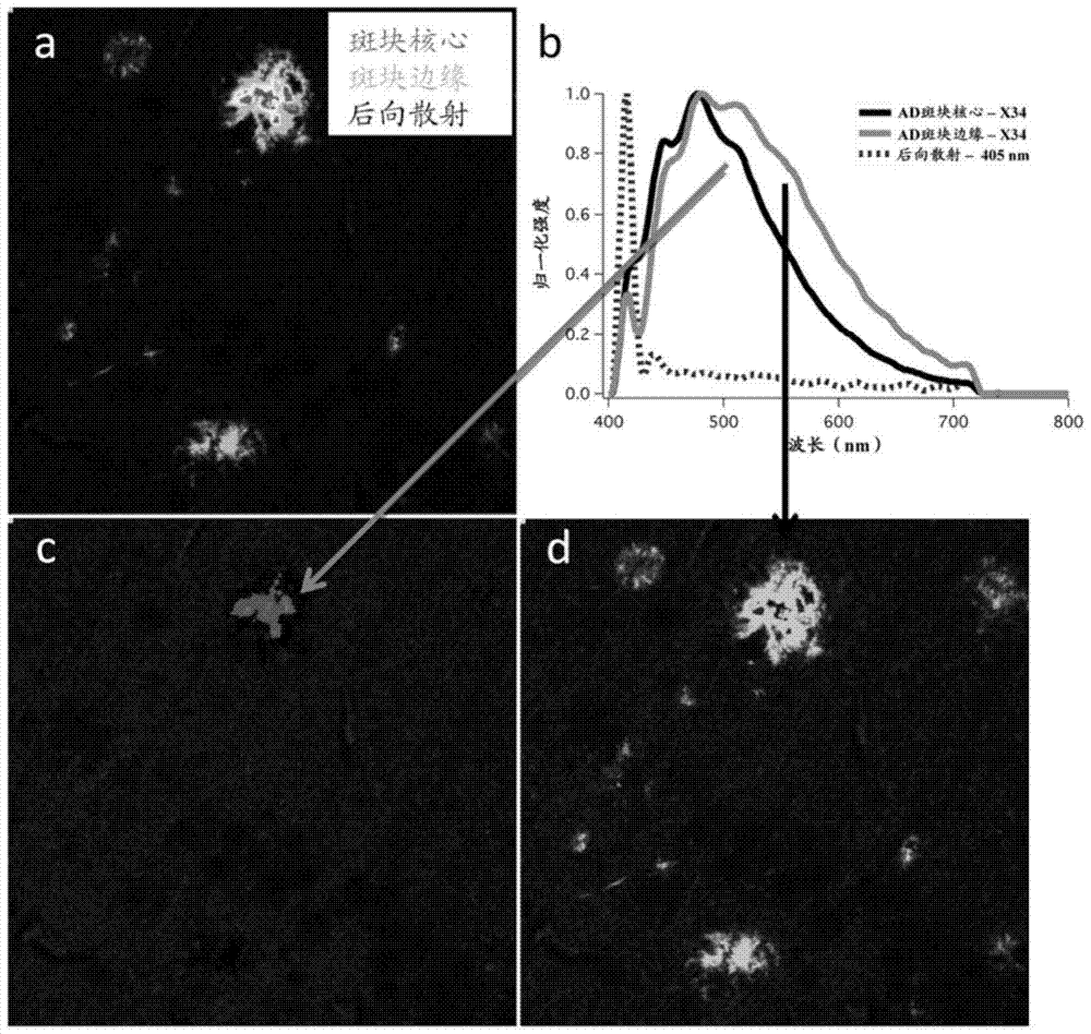 Method for analyzing blood to detect diseases associated with abnormal protein aggregation