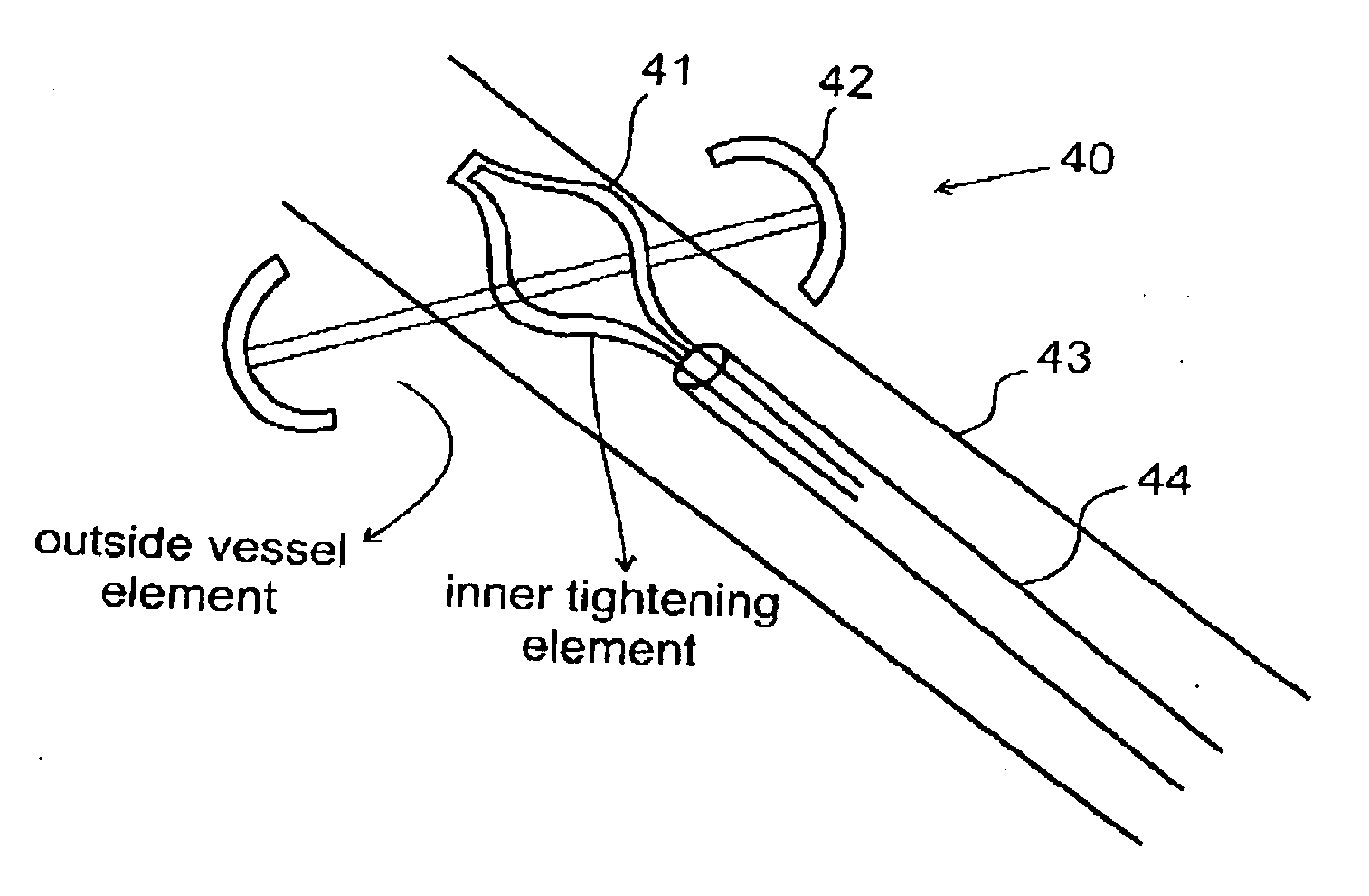 Apparatus and method for enabling perforating vein ablation