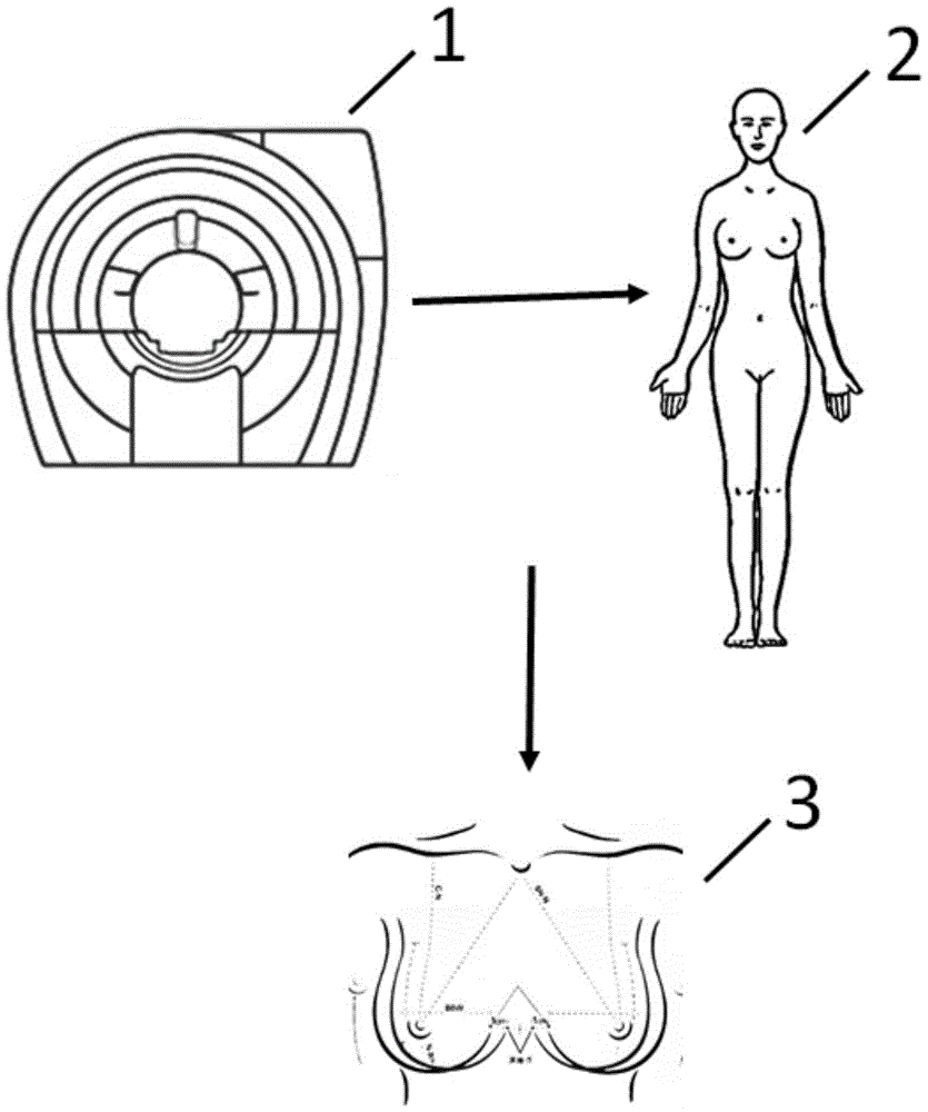 A method for manufacturing breast prosthesis based on three-dimensional printing technology