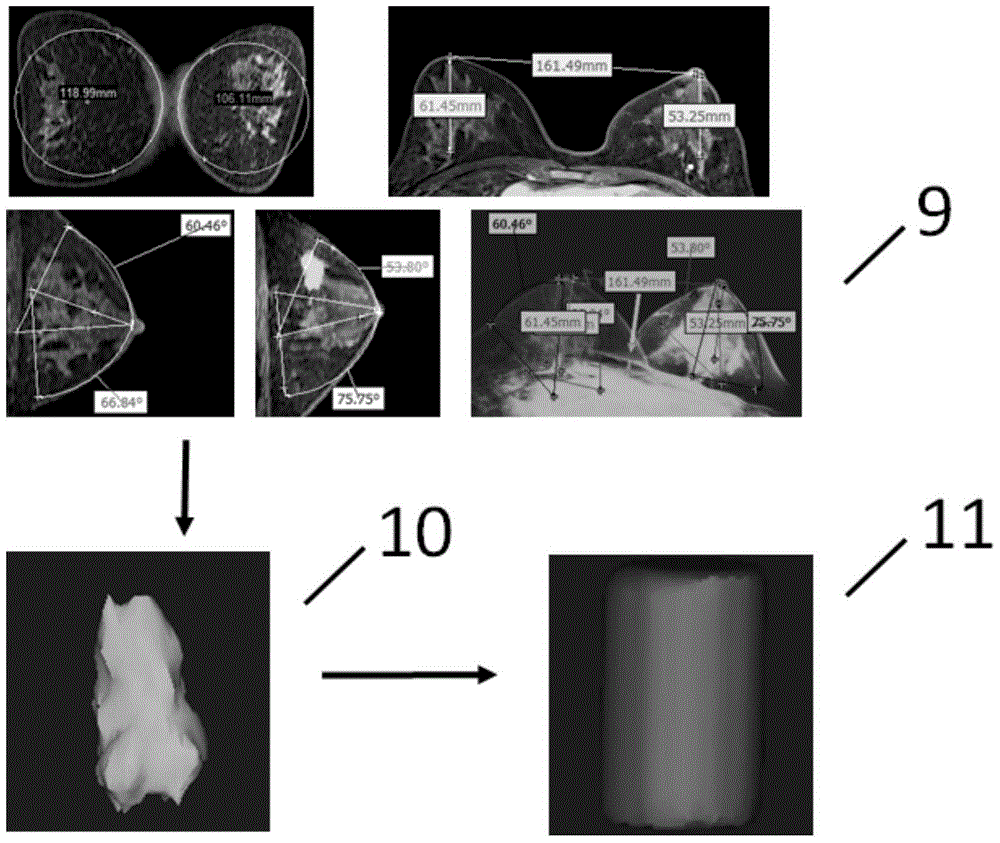 A method for manufacturing breast prosthesis based on three-dimensional printing technology