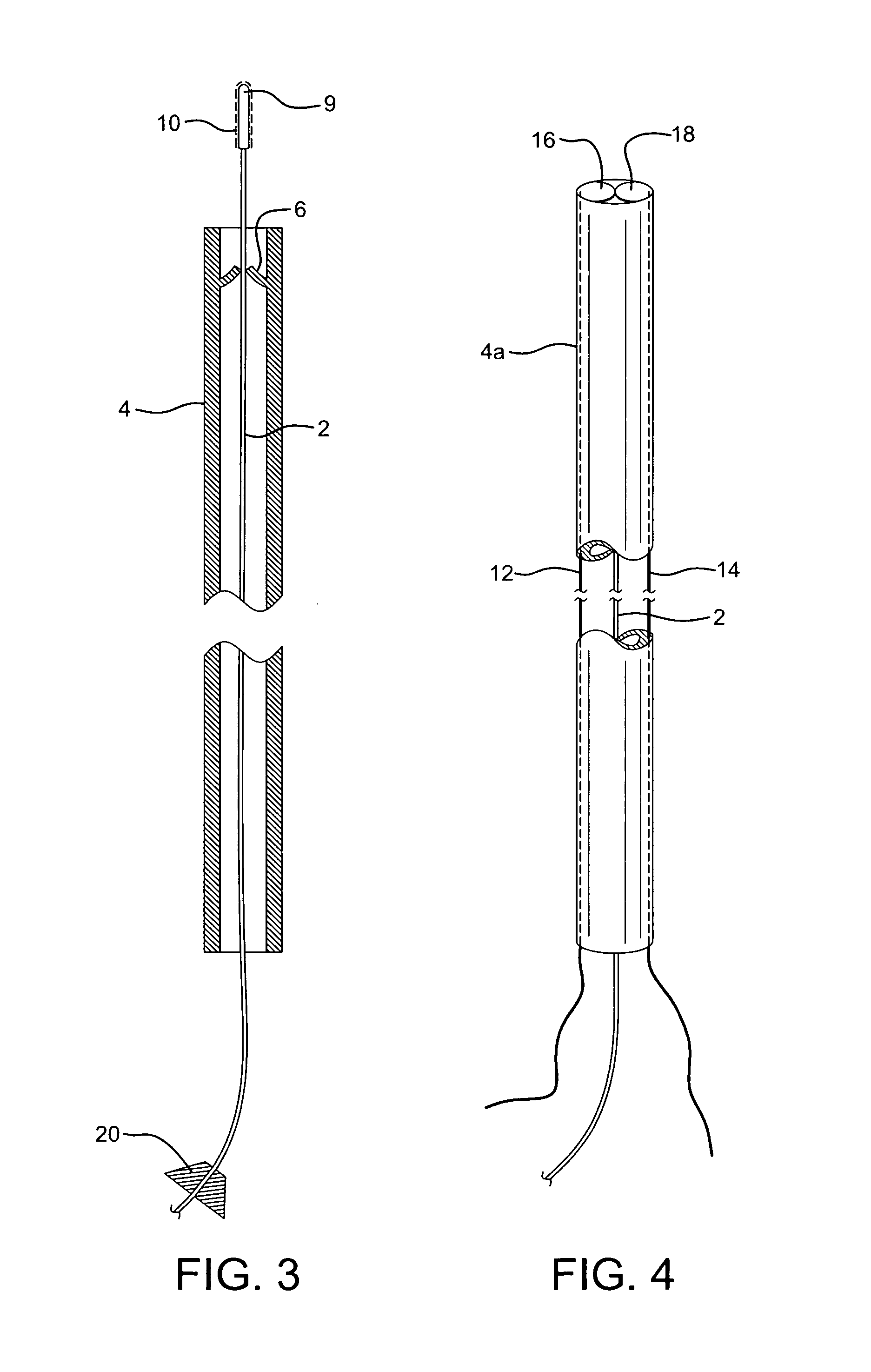 Endovascular device and clotting system for the repair of vascular defects and malformations