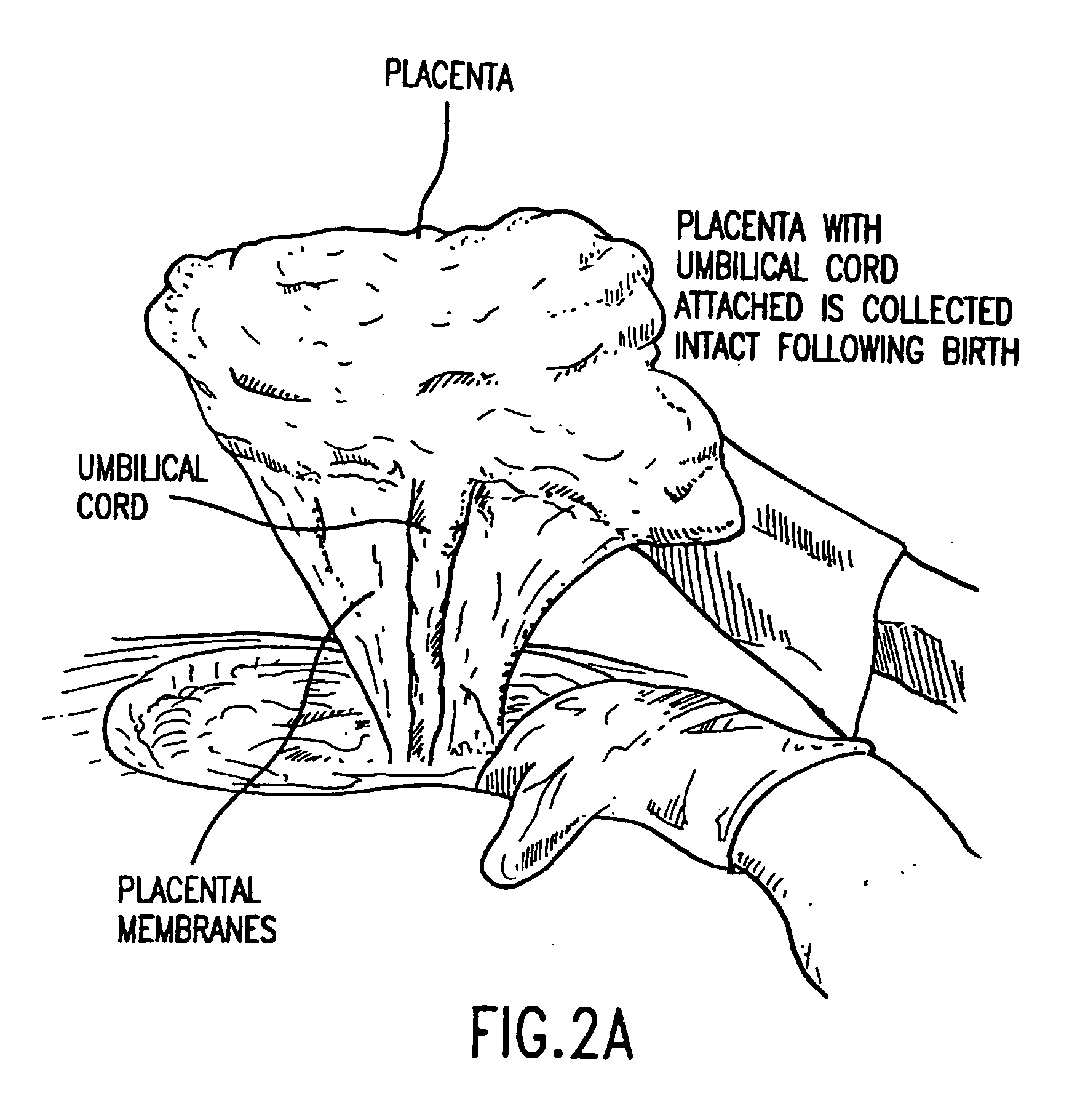 Composition for collecting and preserving placental stem cells and methods of using the composition
