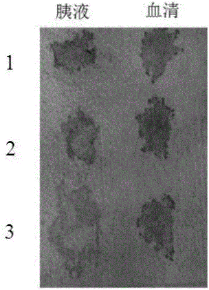 Pancreatic leakage detection material based on acid-base indication compound chemical color changes and application thereof