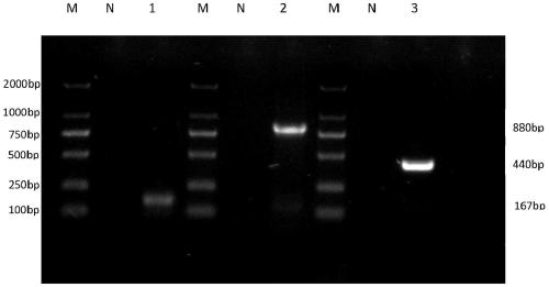 Primer set for simultaneously detecting three kinds of microsporidia and application of primer set