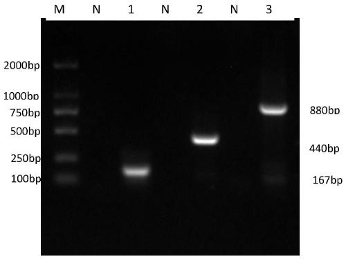 Primer set for simultaneously detecting three kinds of microsporidia and application of primer set