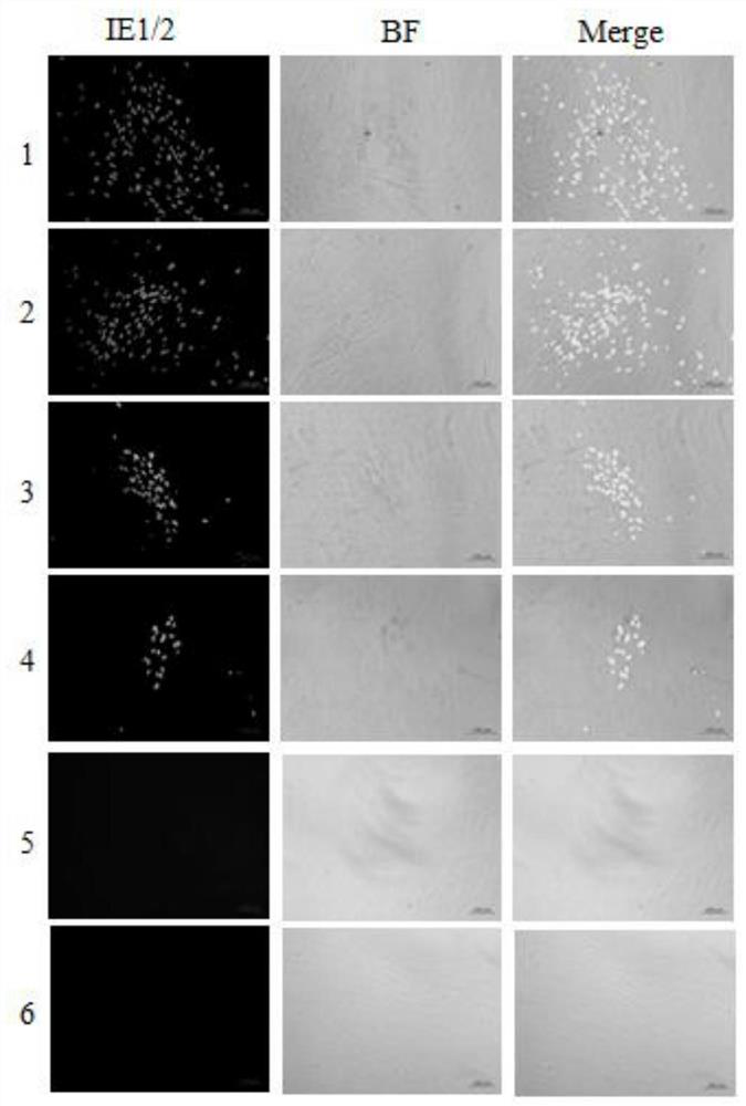 New Application of Corydalin in Prevention and Treatment of Human Cytomegalovirus Infection