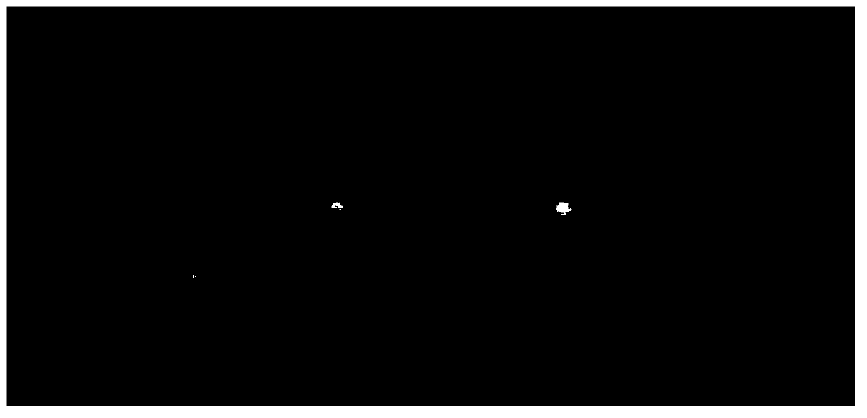 CYP4V2 gene mutant and application thereof