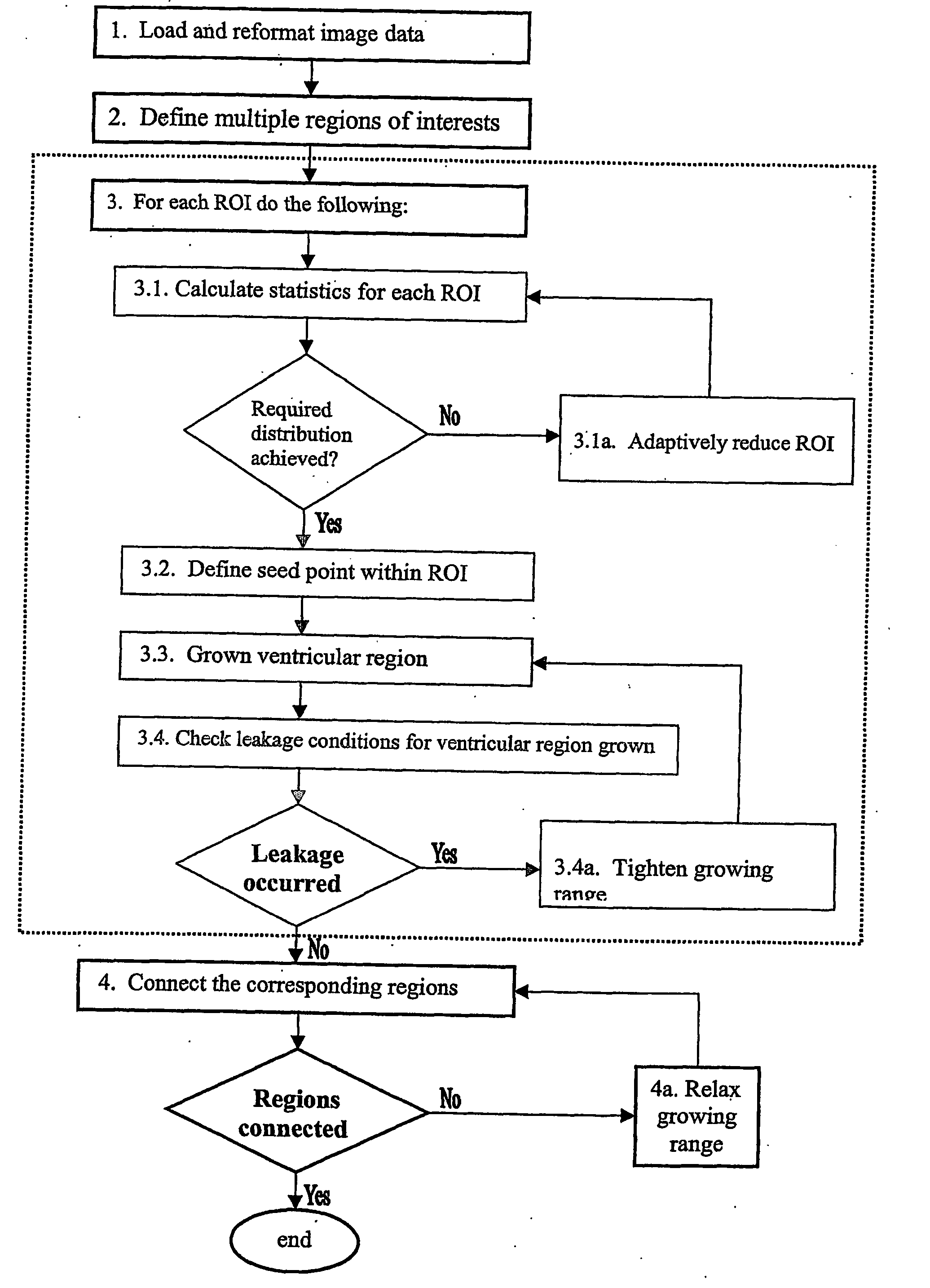 Method and apparatus for extracting cerebral ventricular system from images