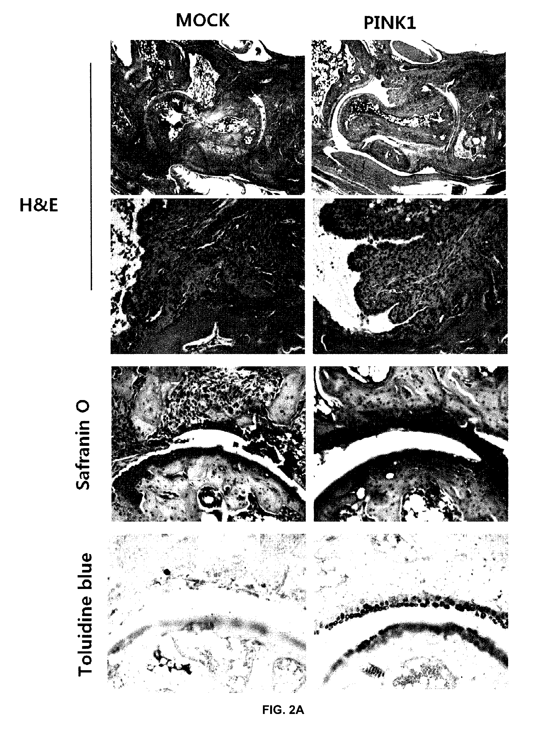 Composition for preventing or treating autoimmune disease, comprising, as active ingredient, PINK1 protein or polynucleotide encoding same