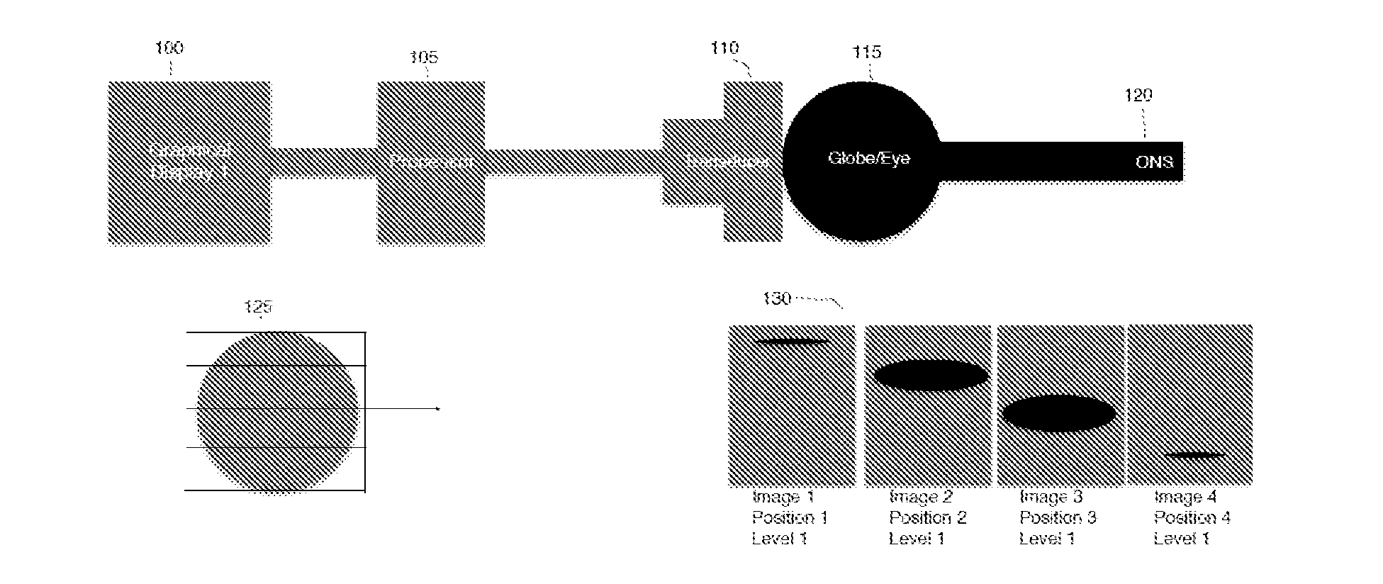 Systems and methods for detecting intracranial pressure and volume