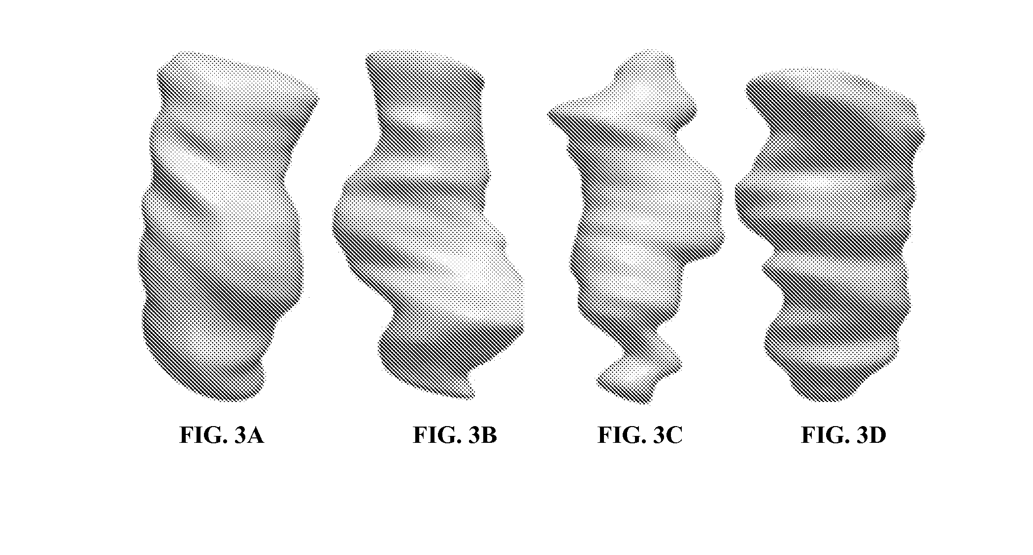 Systems and methods for detecting intracranial pressure and volume