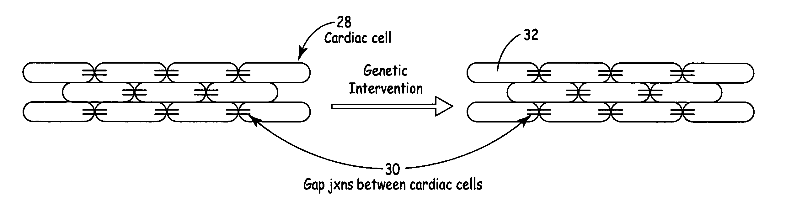 Cellular and genetic intervention to treat ventricular tachycardia