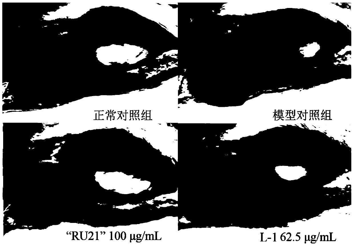 Vigna radiata oligopeptide powder and preparation method thereof