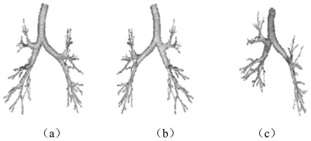 A predictive method for chronic obstructive pulmonary disease based on reconstructed airway tree images