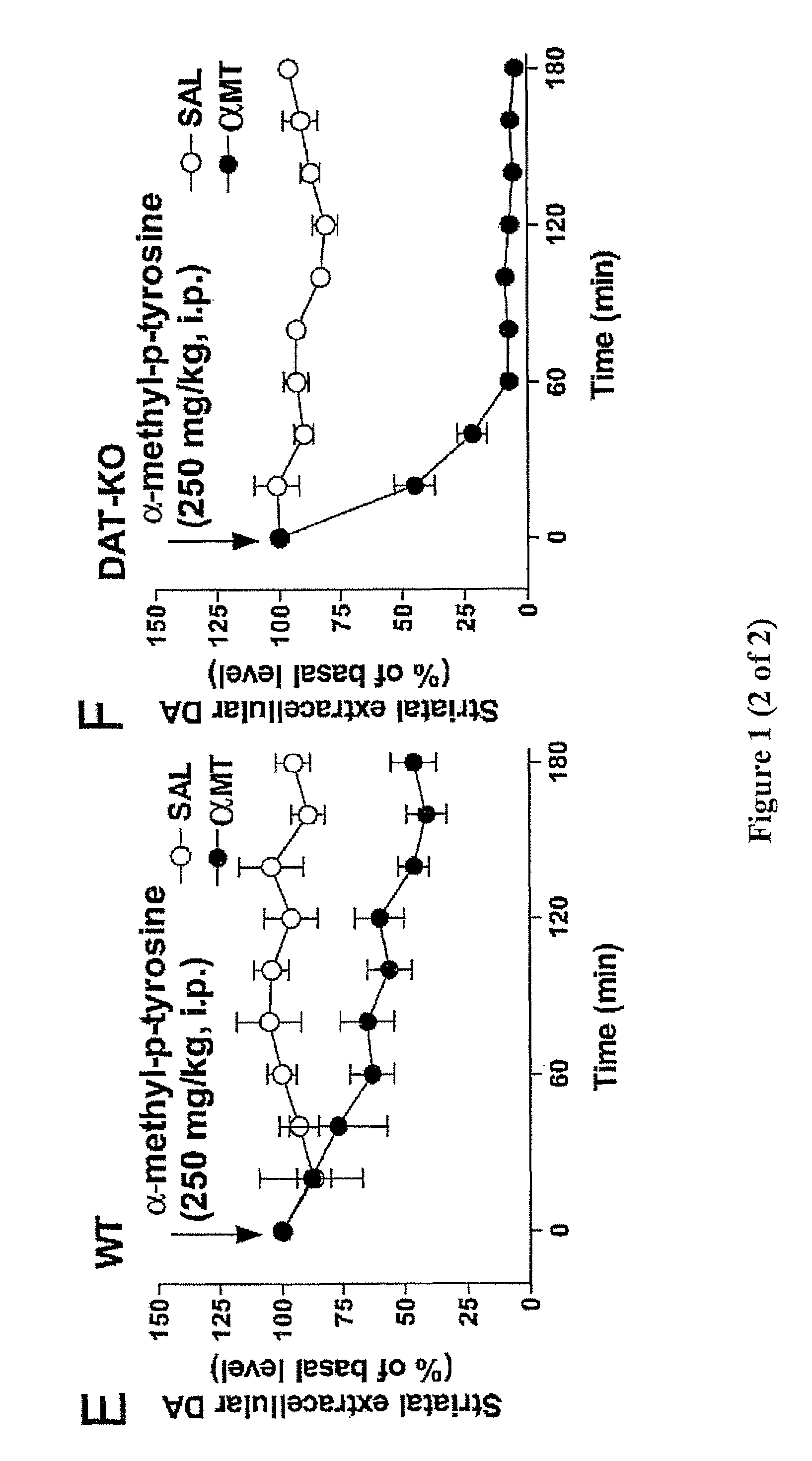 Antiparkinsonian action of phenylisopropylamines