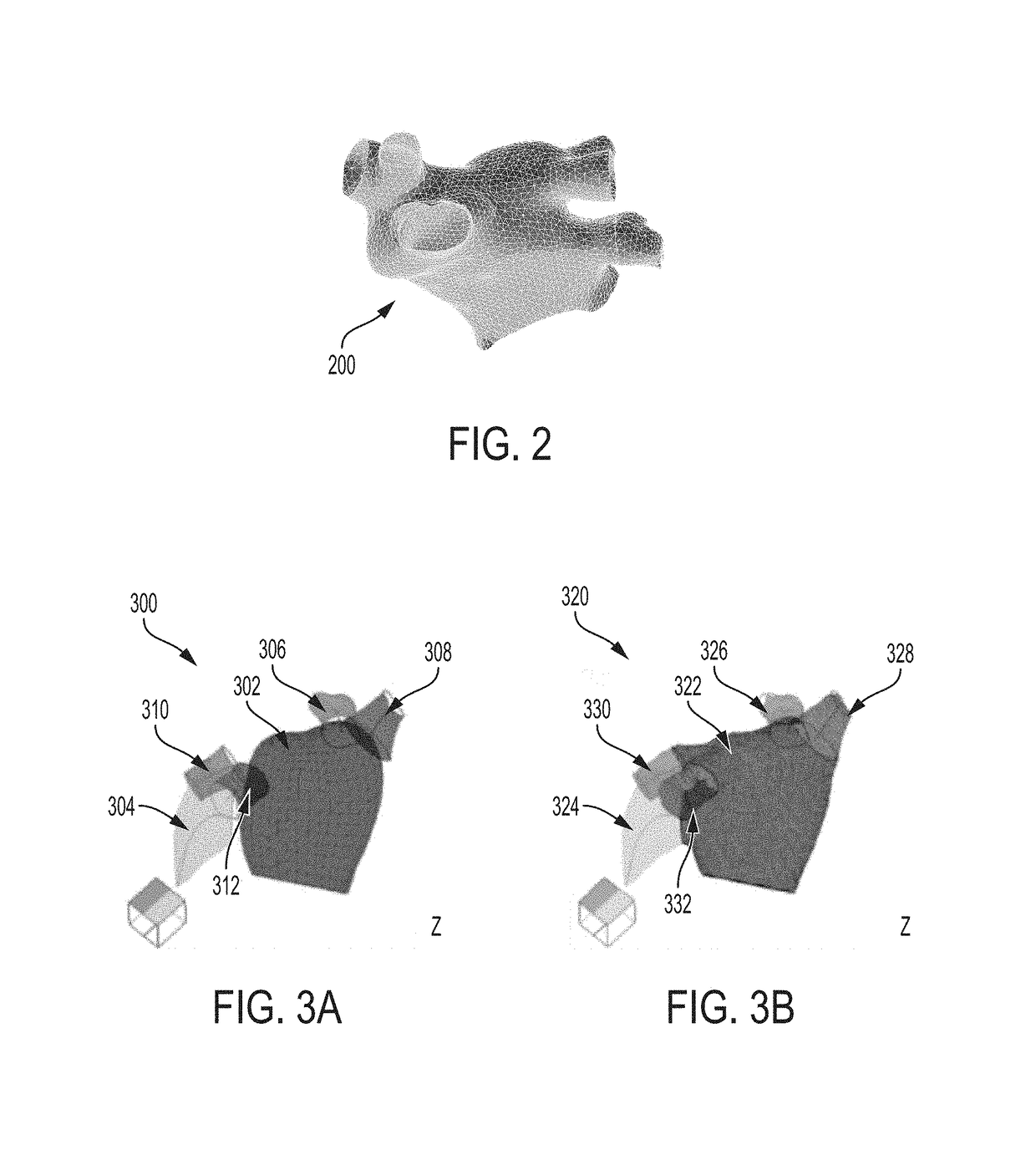 System and Method for Medical Image Based Cardio-Embolic Stroke Risk Prediction