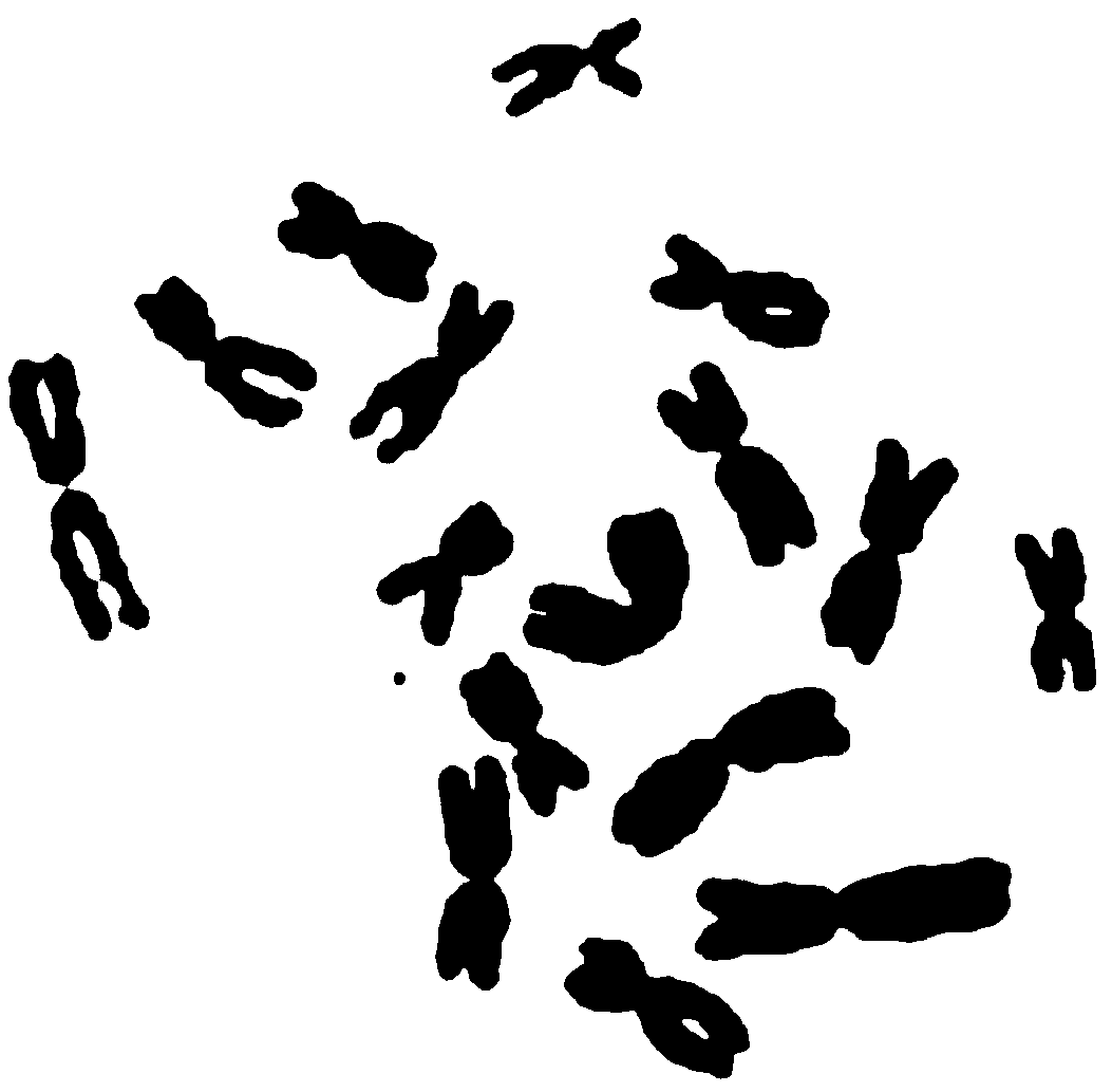 Preparation method of turbellarian worm chromosome specimen