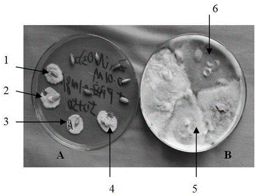 Method for detecting fungi carried by rice seeds by using improved rose Bengal culture medium