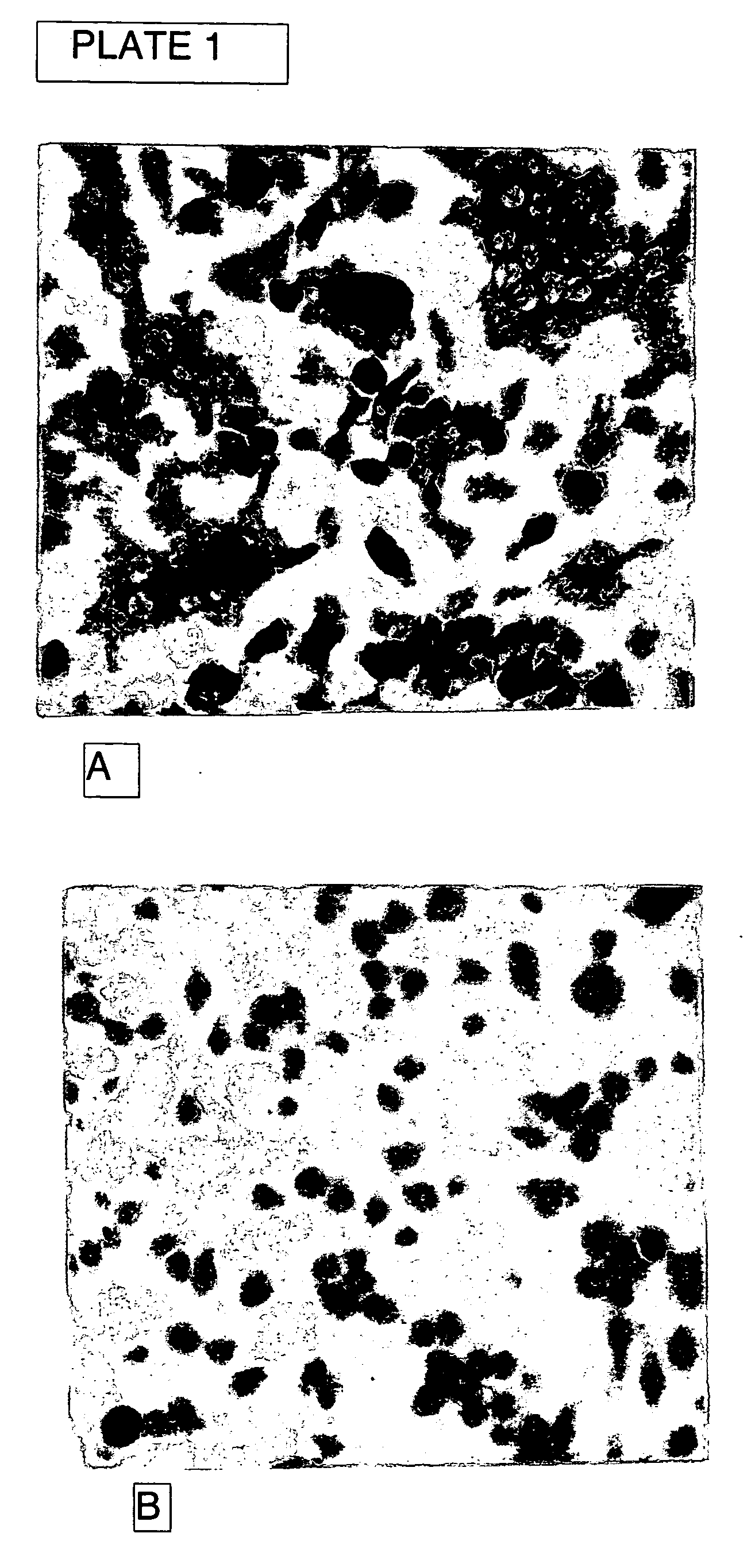 Method and composition for treating osteoporosis