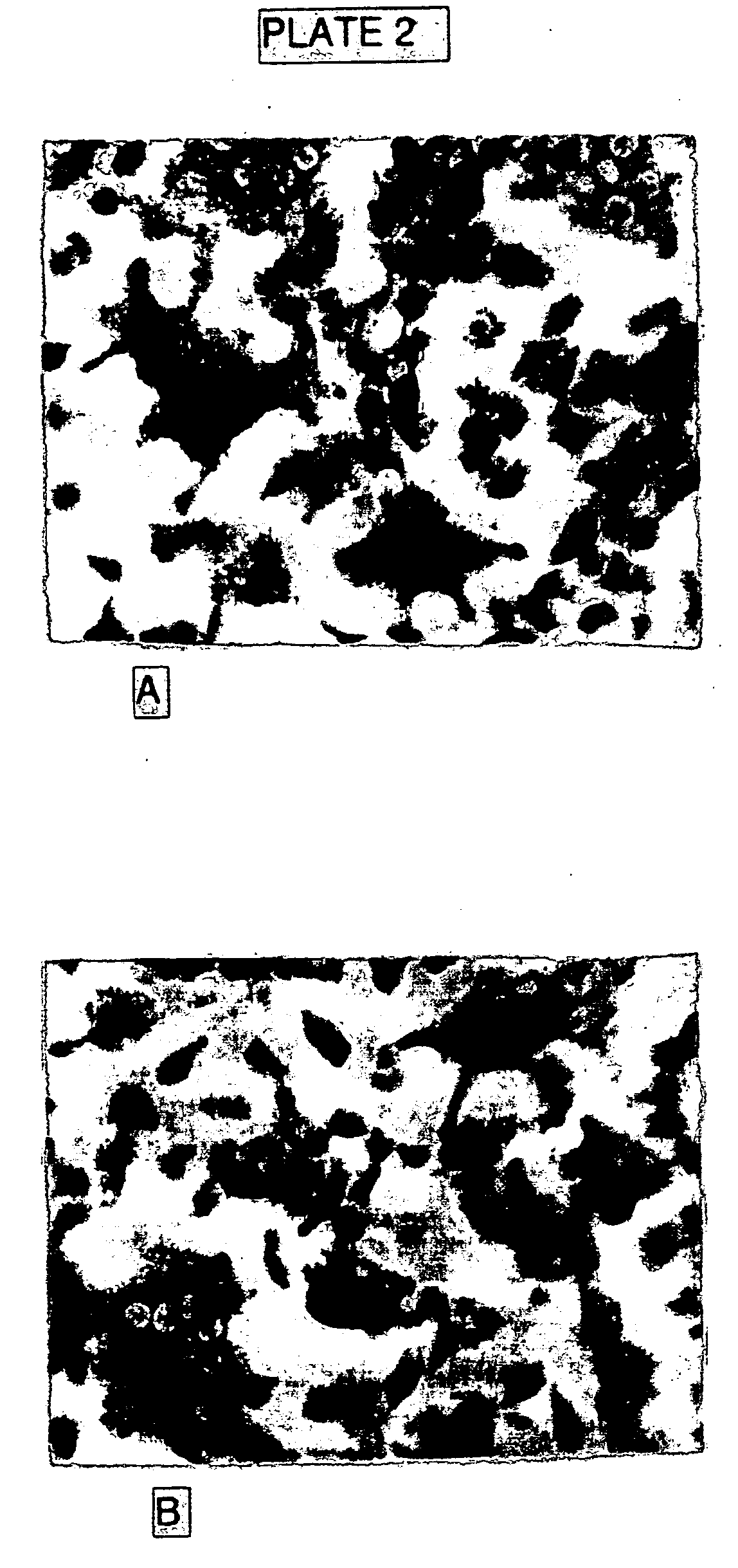 Method and composition for treating osteoporosis