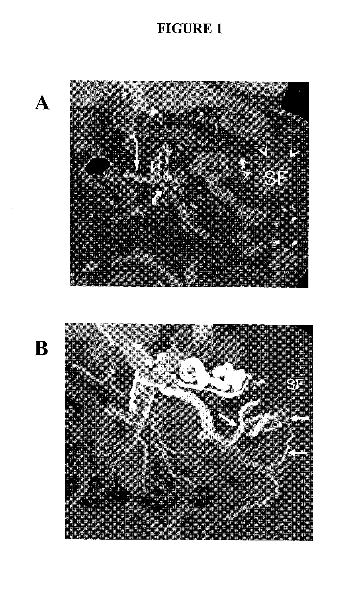 Targeted treatment of anerobic cancer