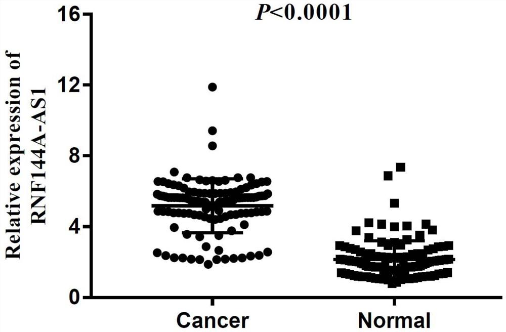 Primer and kit for detecting serum exosome RNF144A-AS1 and application of primer and kit in diagnosis and treatment of liver metastasis of gastric cancer