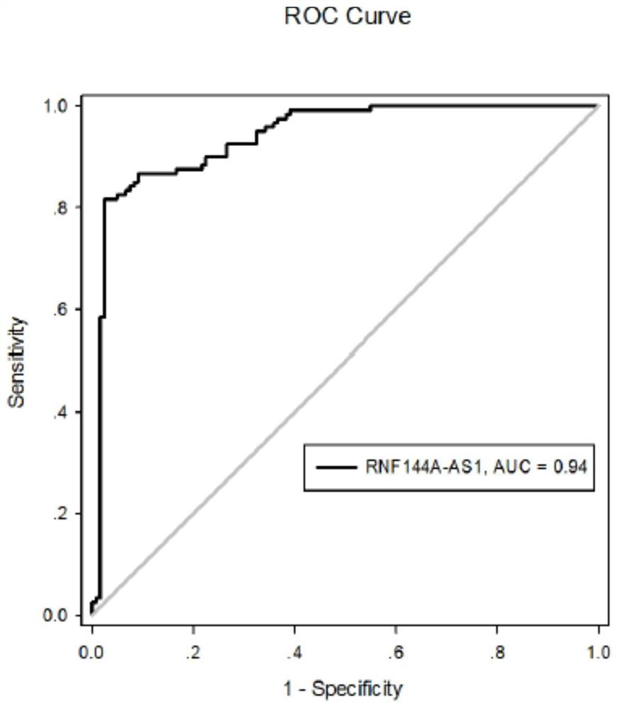 Primer and kit for detecting serum exosome RNF144A-AS1 and application of primer and kit in diagnosis and treatment of liver metastasis of gastric cancer
