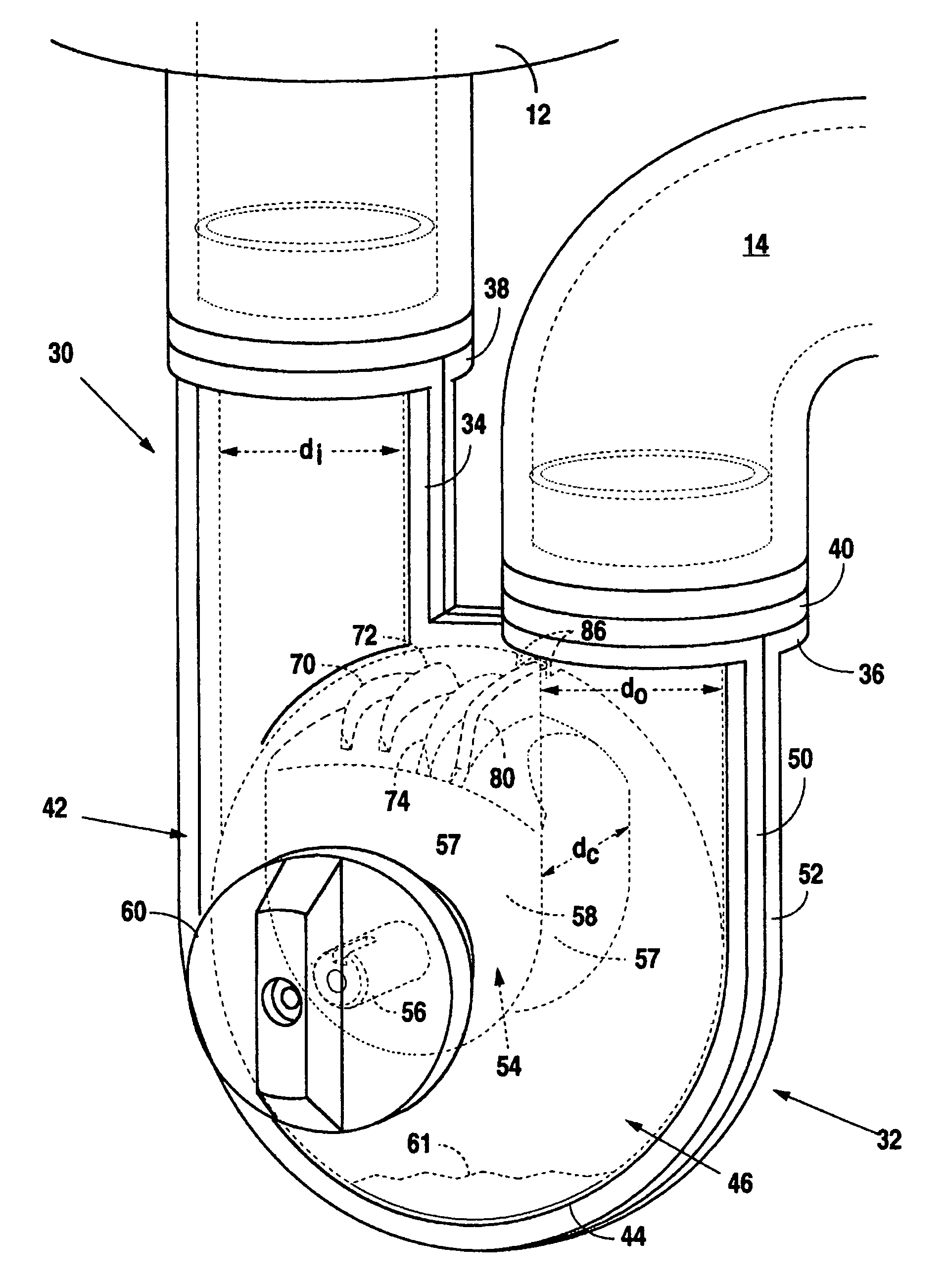 Method and apparatus for cleaning a conduit