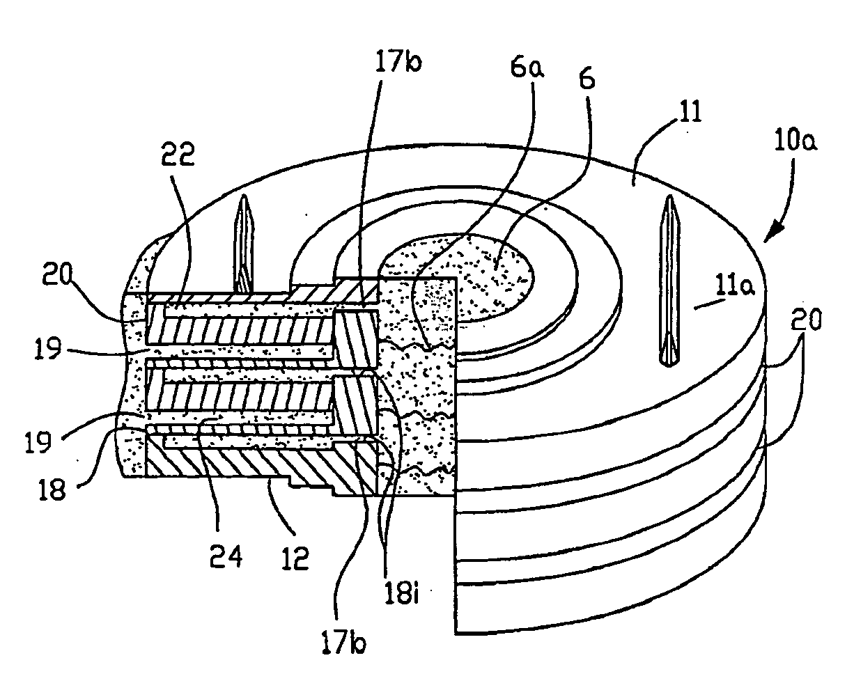 Intervertebral Prosthesis for Supporting Adjacent Vertebral Bodies Enabling the Creation of Soft Fusion and Method