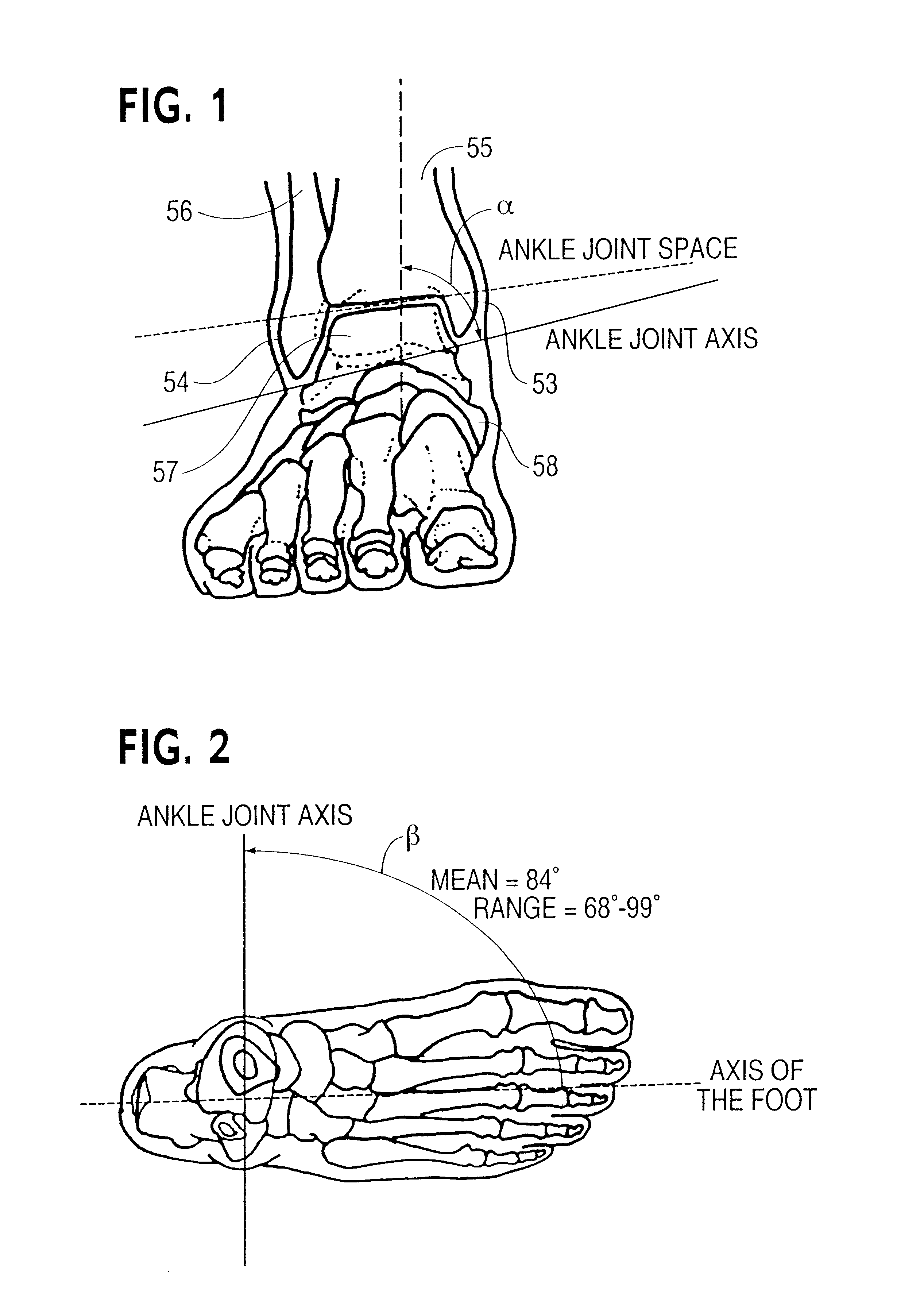 Shoe, ankle orthosis and method for protecting the ankle