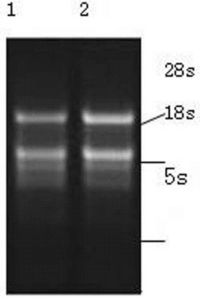 Method for constructing adenovirus for efficient package and expression of melanoma differentiation-associated gene-7