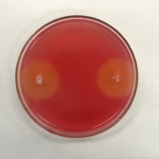 A strain of Bacillus mohewei cjx-61 and its application