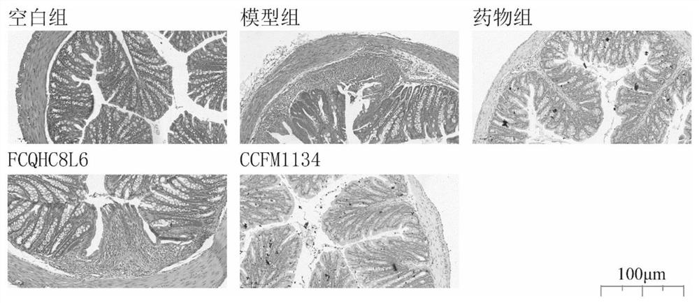 Lactobacillus reuteri CCFM1134 for preventing and relieving ulcerative colitis and application thereof