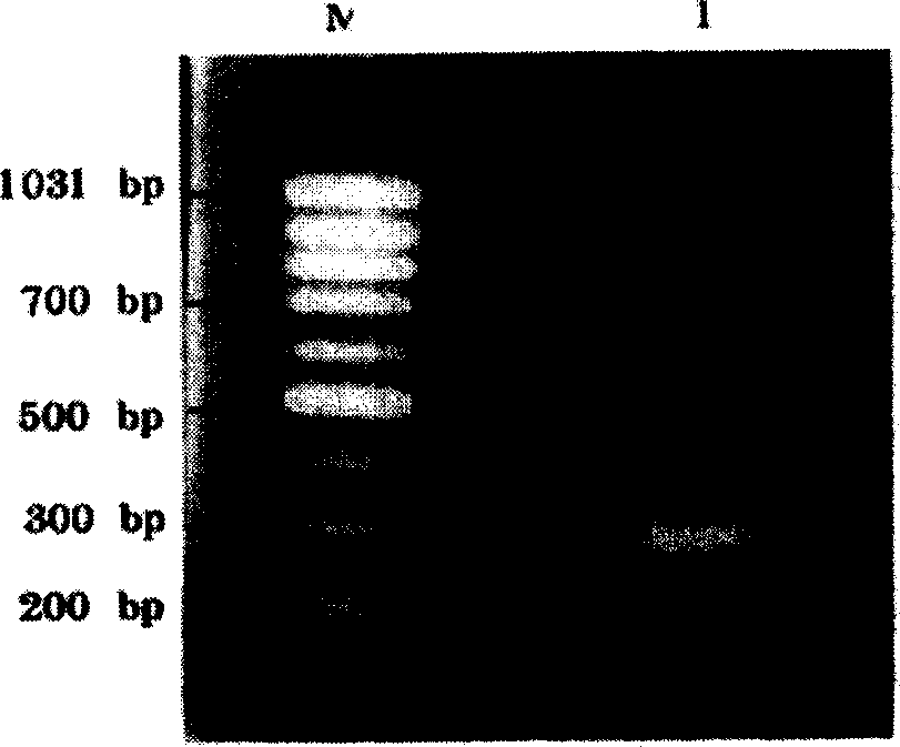 Method for preparing mB7.1-GPI fusion proteins and their uses