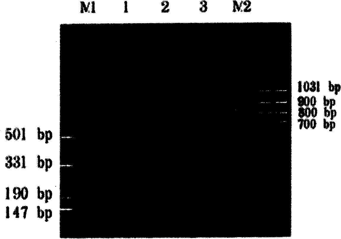 Method for preparing mB7.1-GPI fusion proteins and their uses