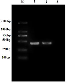 Weever rhabdovirus recombinant G2 protein and application thereof