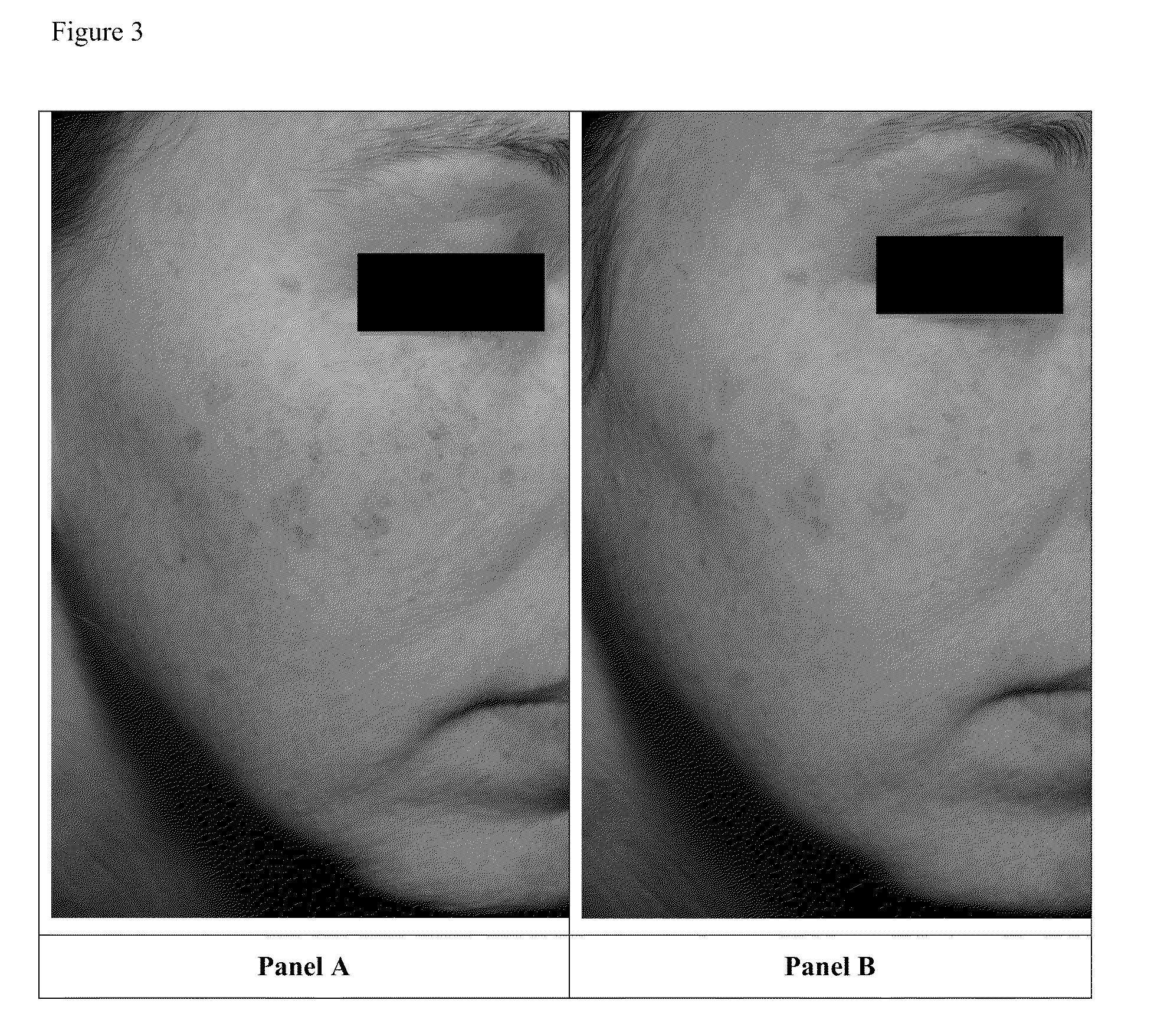 Calcium sequestration compositions and methods of treating skin pigmentation disorders and conditions
