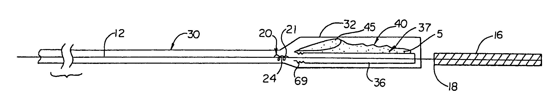 Vascular embolic filter devices and methods of use therefor