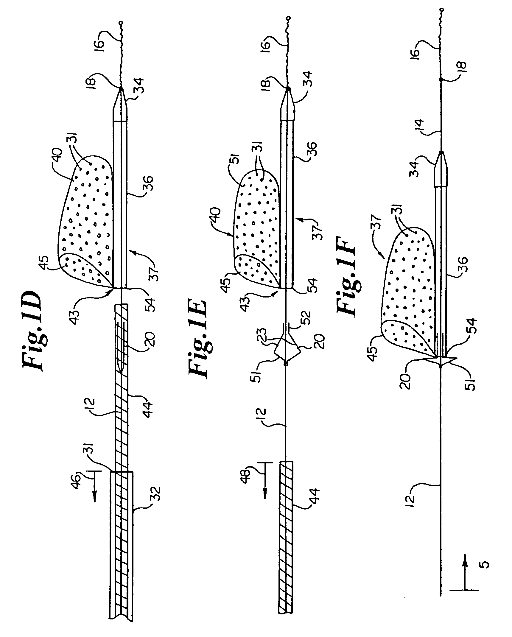 Vascular embolic filter devices and methods of use therefor