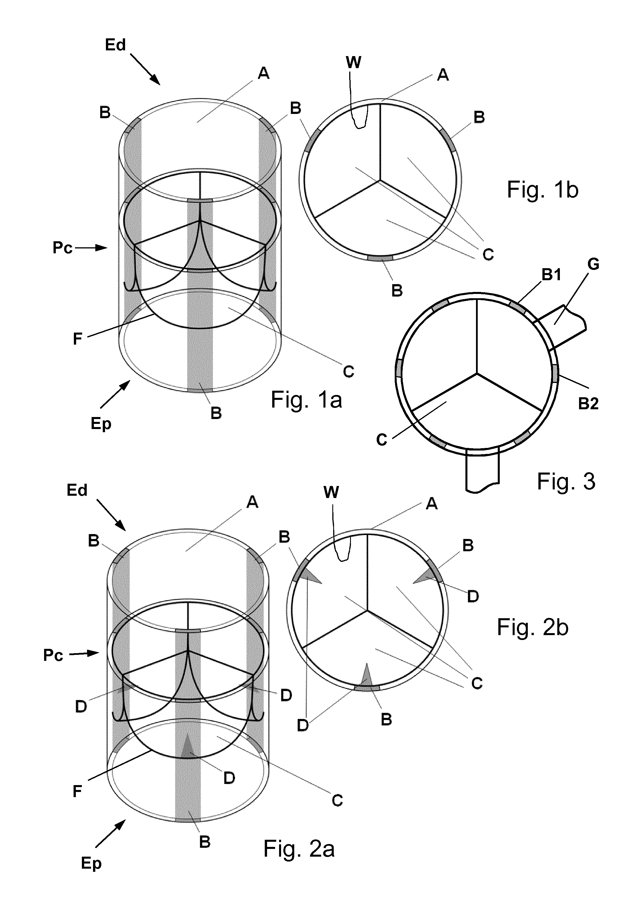 Biological heart valve replacement, particularly for pediatric patients, and manufacturing method