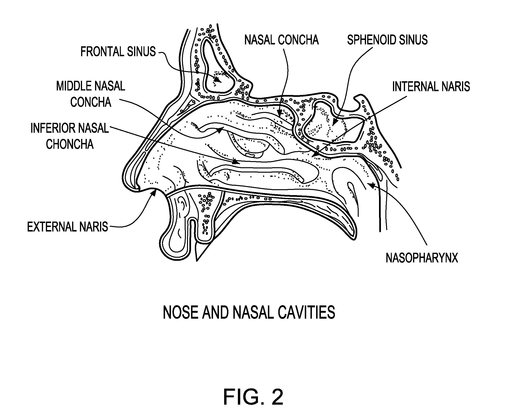 Methods for detecting antibodies in mucosal samples and device for sampling mucosal material