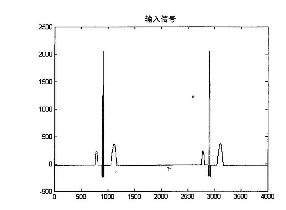 Power frequency interference filtering method for eliminating ringing