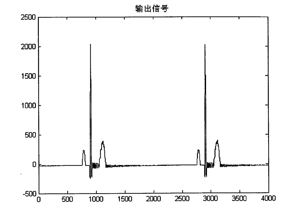 Power frequency interference filtering method for eliminating ringing