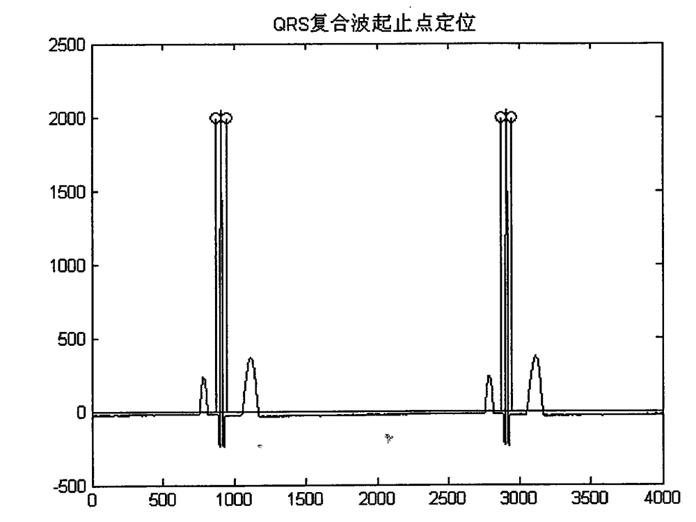 Power frequency interference filtering method for eliminating ringing