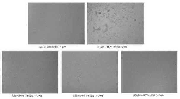 Antibacterial gel containing sulfated polysaccharide-nano-silver complex and application of antibacterial gel