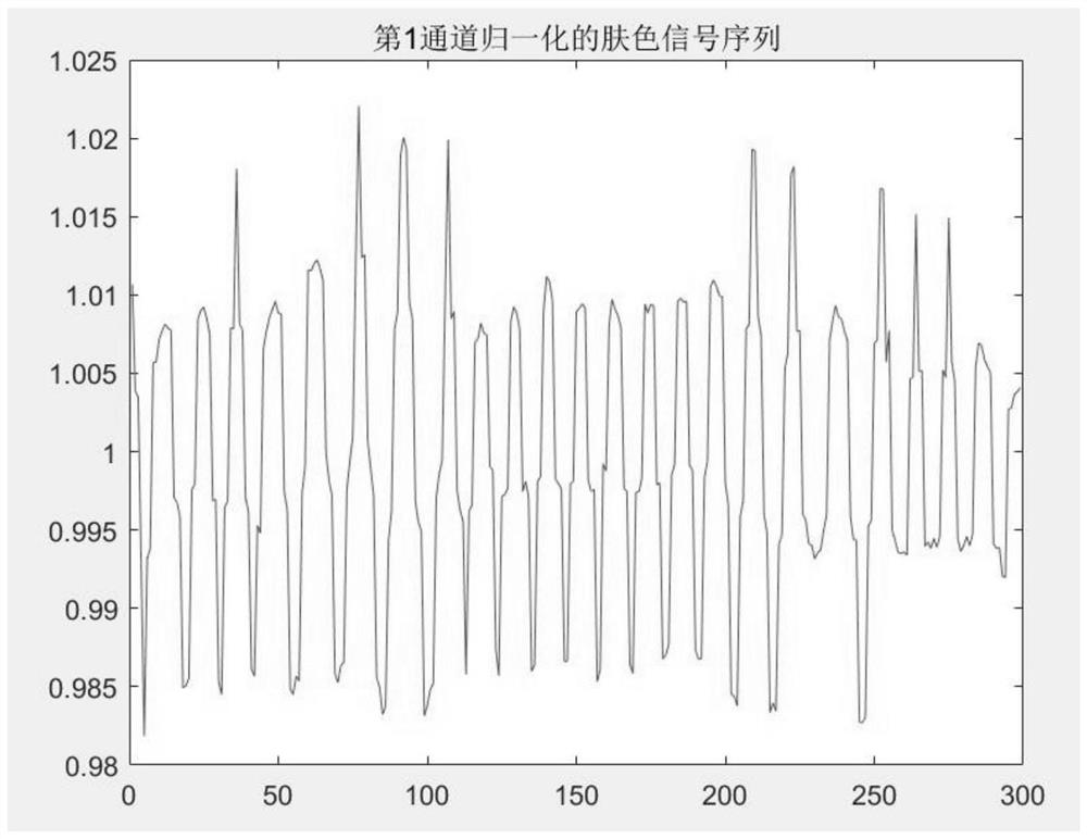 Premature infant skin moisture analysis method and system