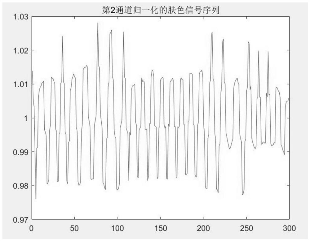 Premature infant skin moisture analysis method and system