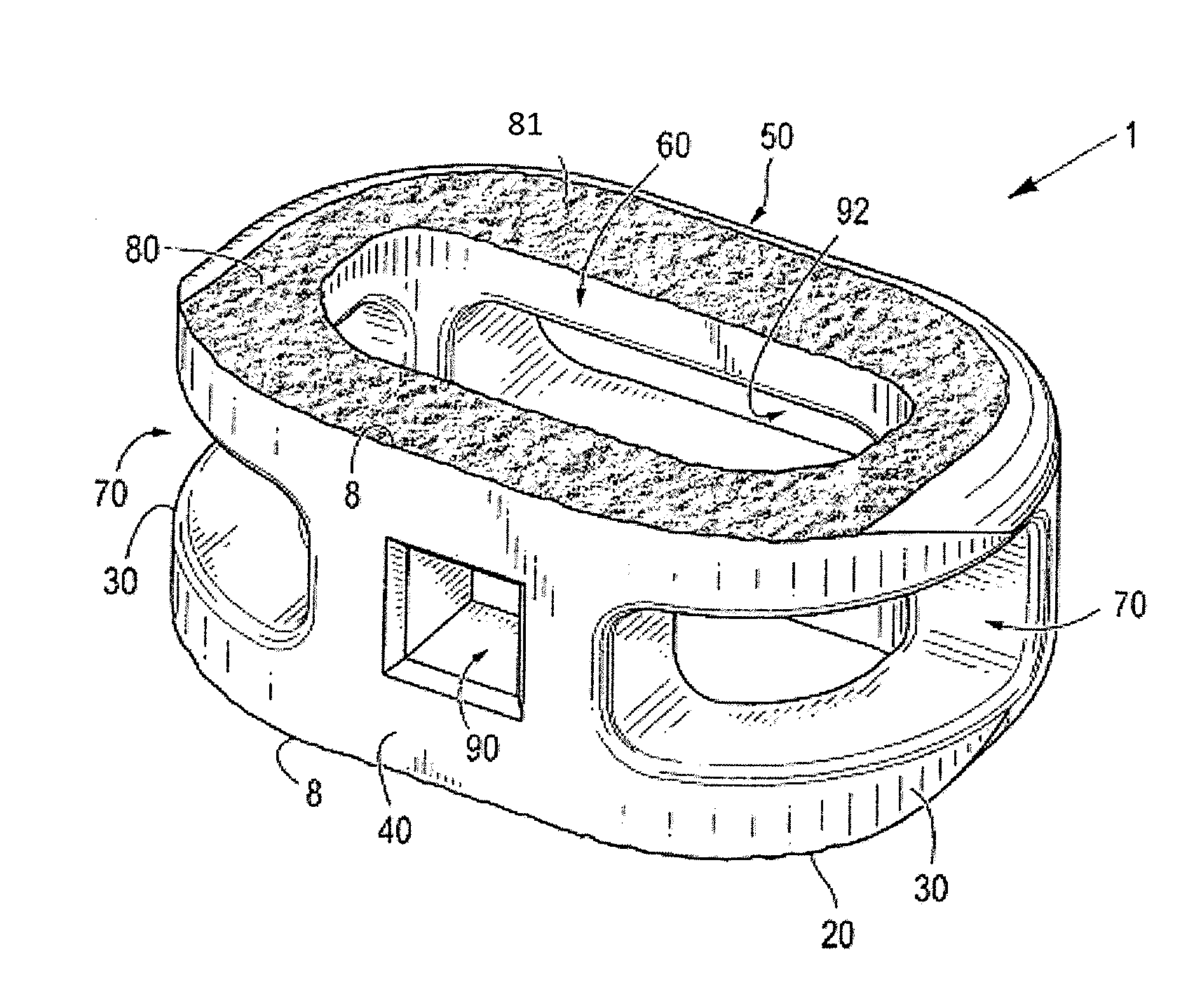 Process of fabricating composite implants having integration surfaces composed of a regular repeating pattern